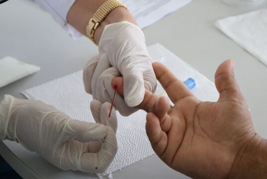 Piauí registra 60 casos confirmados e dois óbitos por Covid-19 nas últimas 24 horas