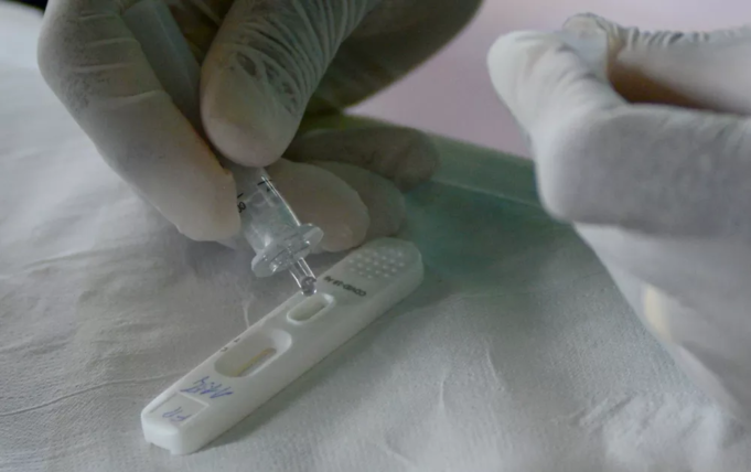 Autoteste de Covid-19: Anvisa concede o primeiro registro de produto no Brasil